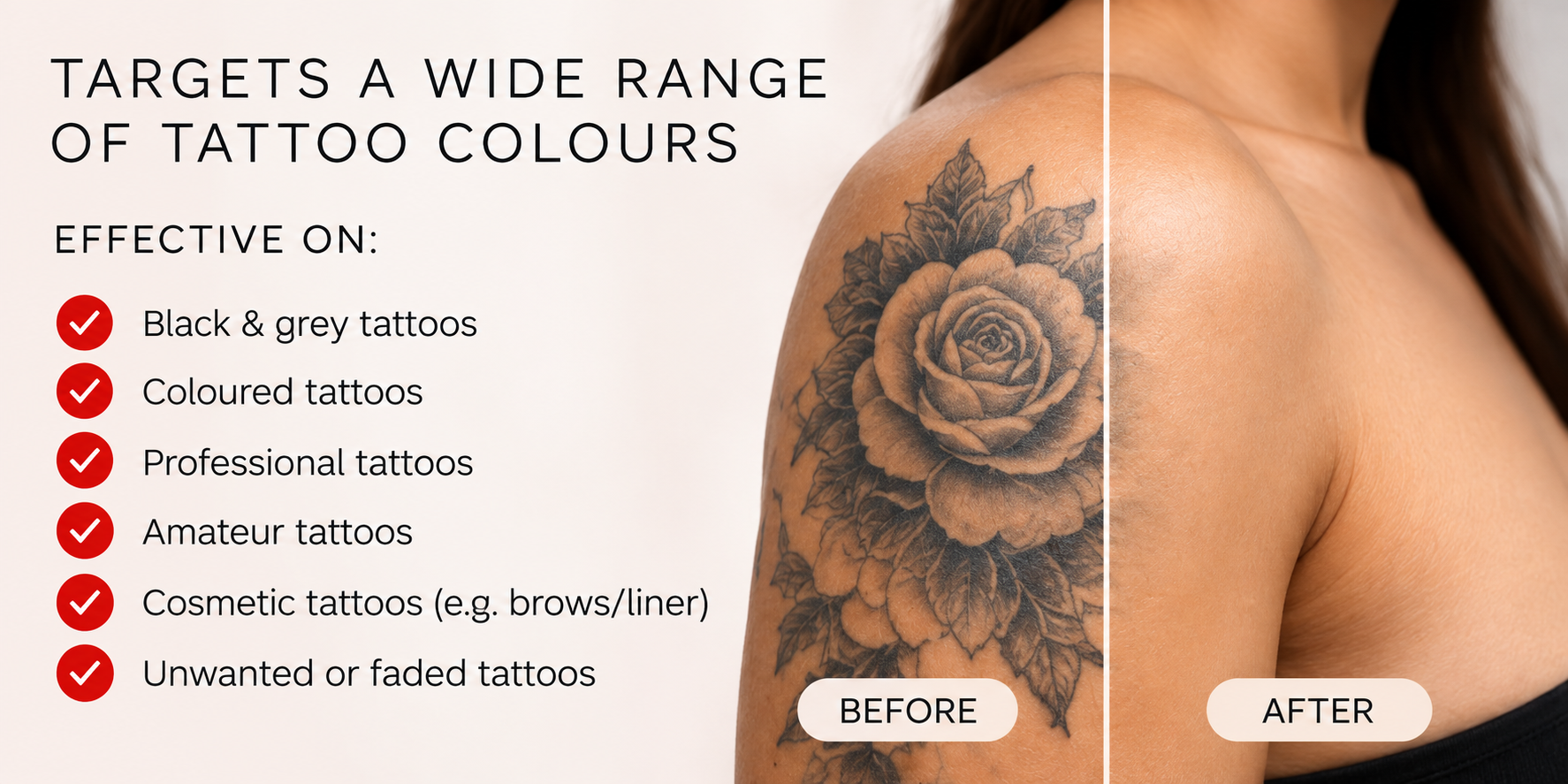 JK JOGGY KANG LASER SPA SKIN CARE NORTHAMPTON TATTOO REMOVAL TARGETED TREATMENT • ADVANCED TECHNOLOGY • PERSONALISED CARE1