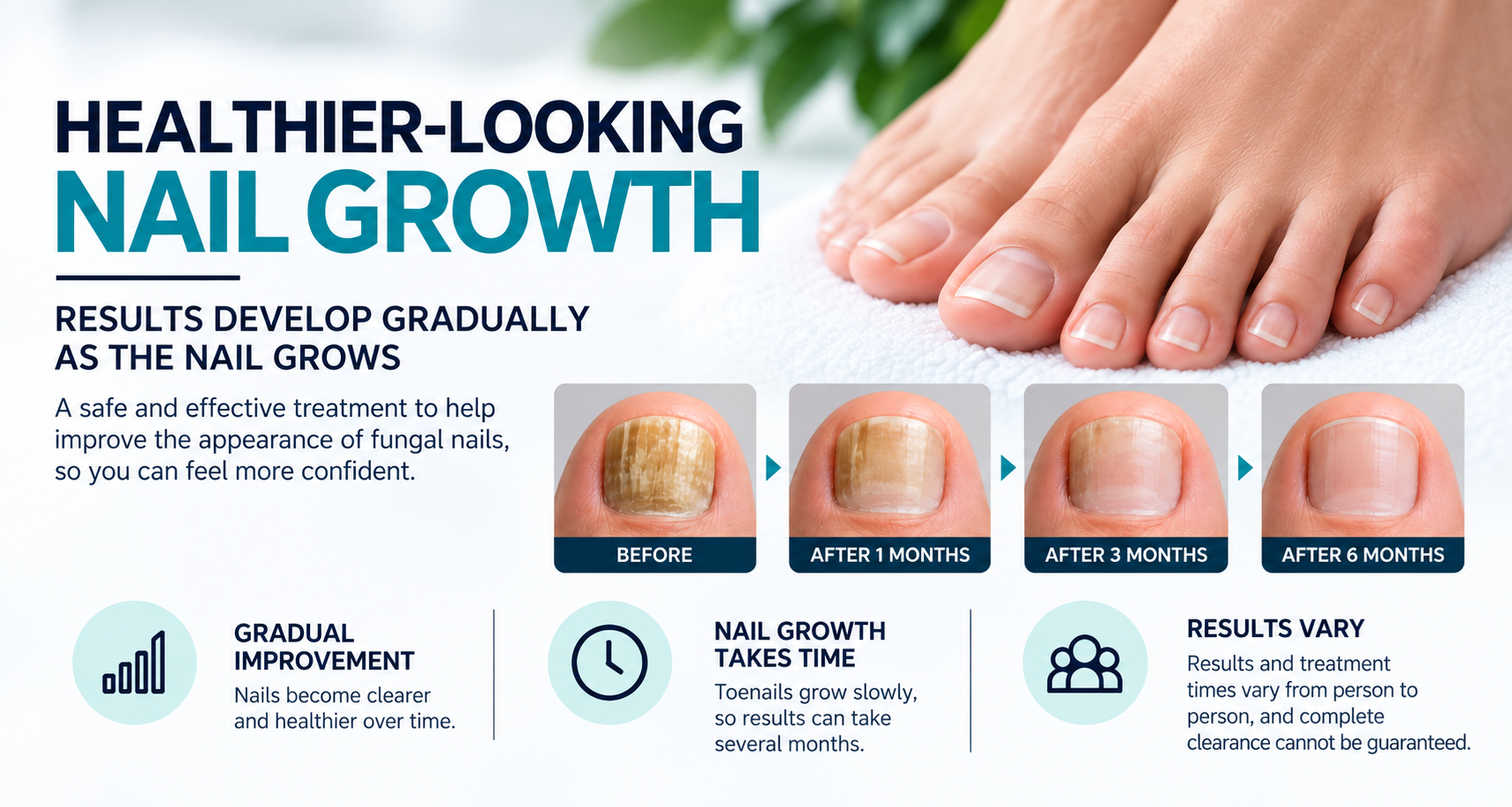 JK JOGGY KANG SKIN LASER SPA CLINIC FUNGAL NAIL TREATMENT NORTHAMPTON HEALTHIER-LOOKING NAILS 6